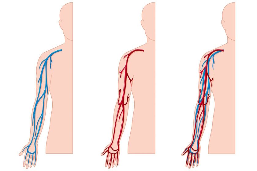 Common Artery and Vein Problems You Should Know About artery vs vein